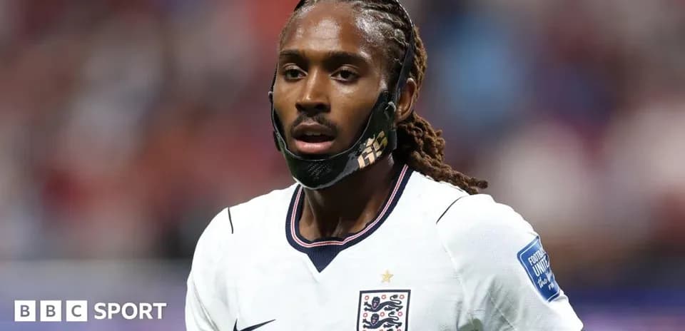 Jugador de Inglaterra con máscara en el campo