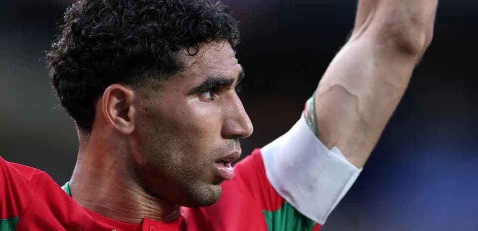 Jugador levantando la mano en el partido