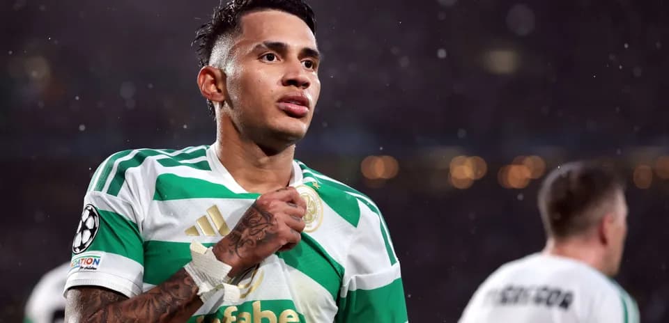 Jugador de Celtic celebrando en el partido